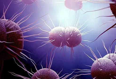 gonorrhea symptoms female — Gonorrhea Symptoms in Females: What They Feel Like and What to Do Next