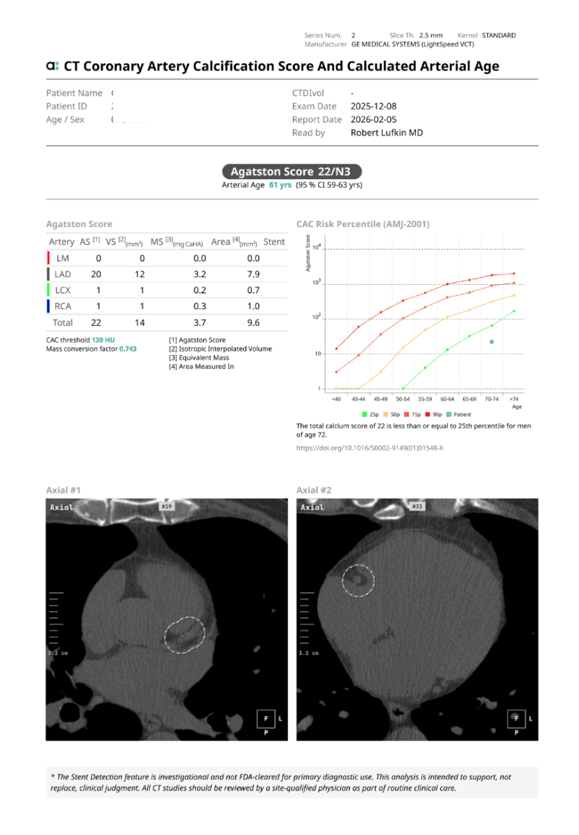 CT Coronary Artery Calcium Score
