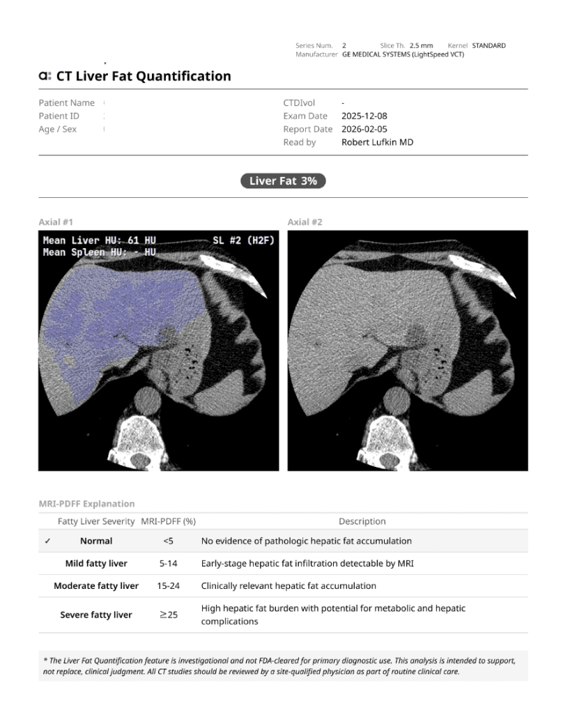 CT Liver Fat Quantification