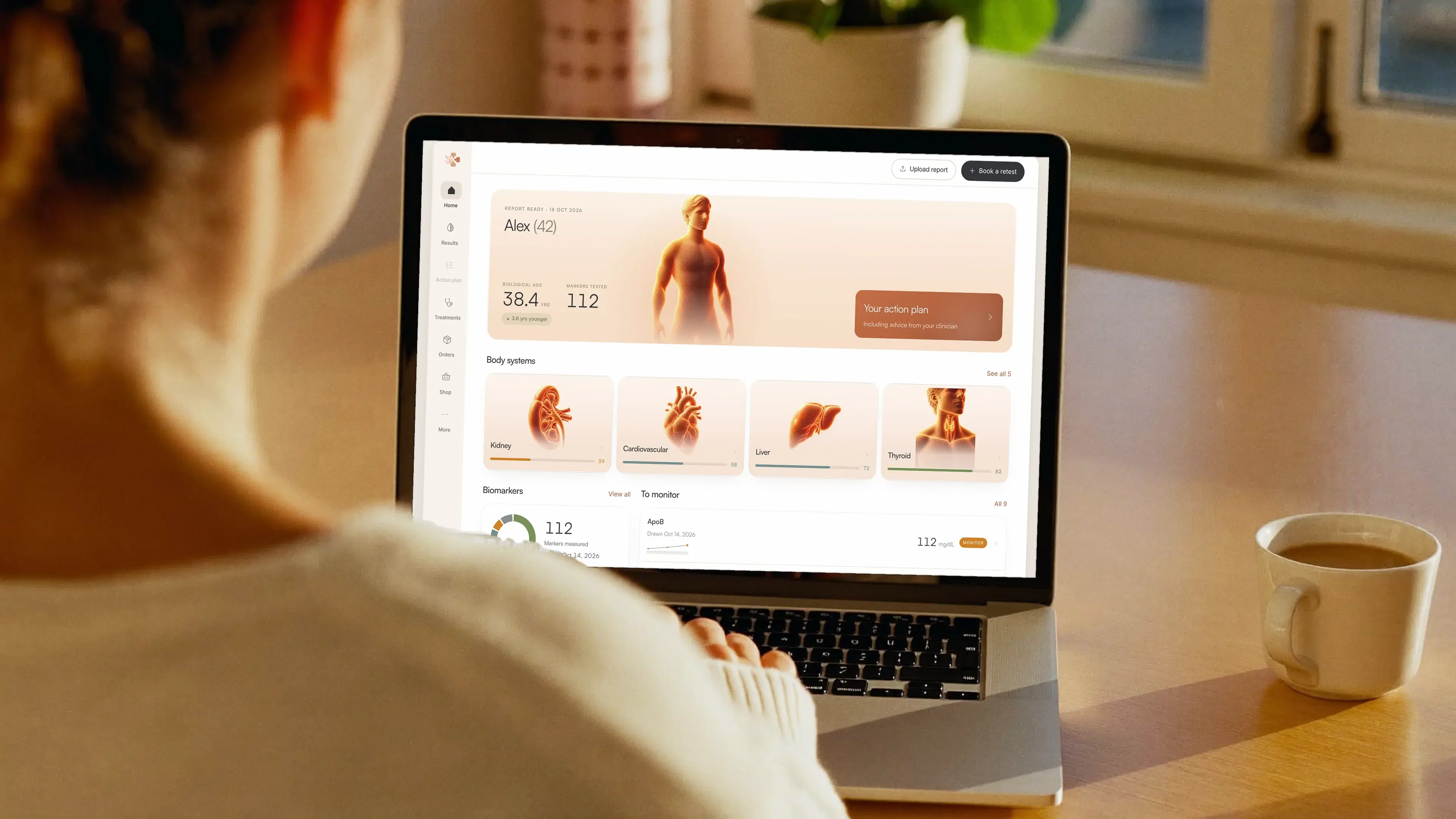 A woman at her kitchen table looking at her Vitals Vault dashboard: biological age, body-system scores and biomarkers