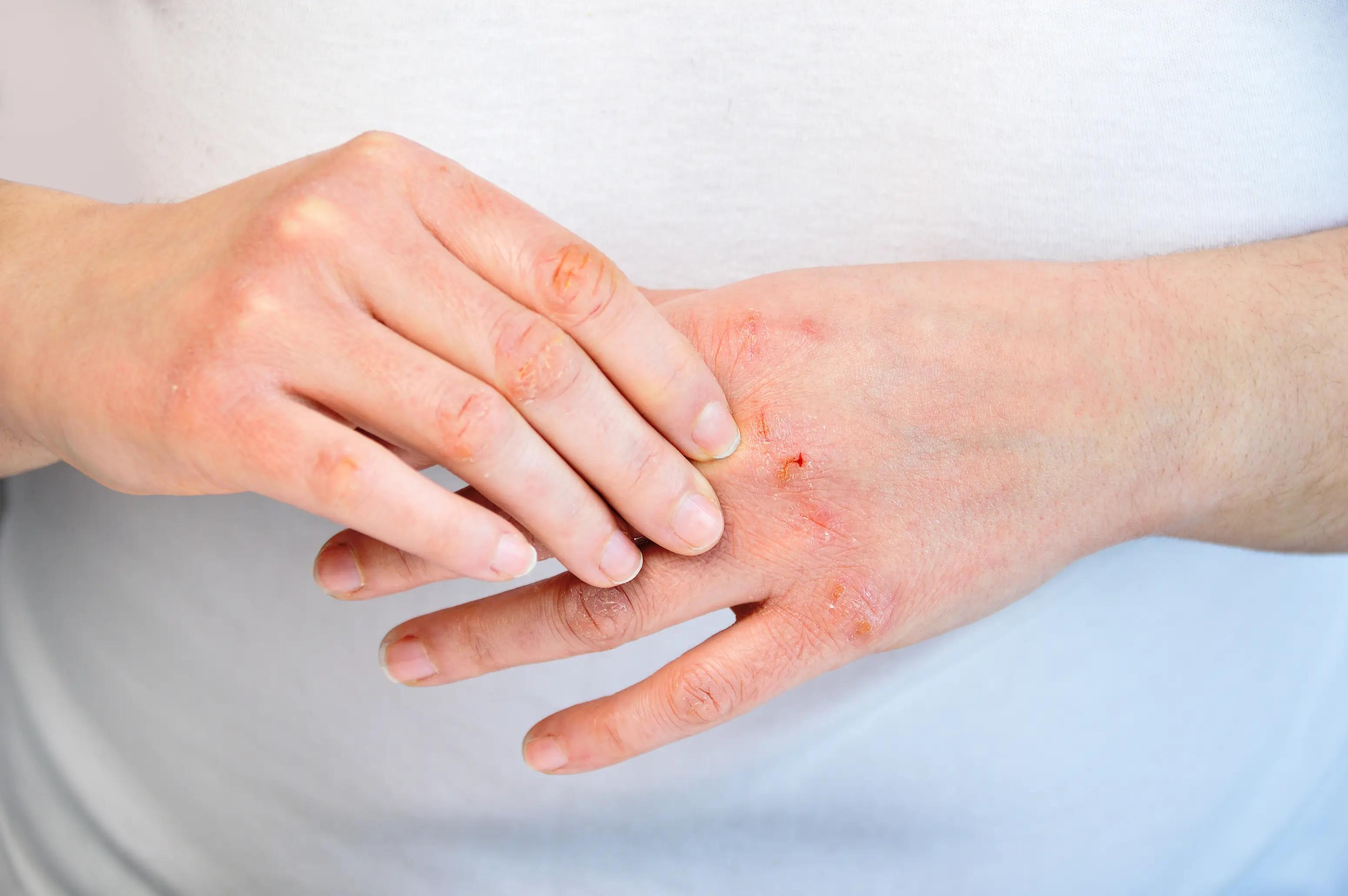 Why Is Your Skin Drier Before You Eat? article illustration