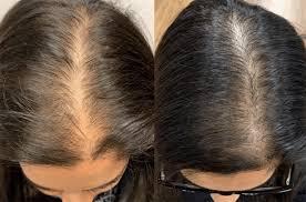 Why Does Your Hair Seem Thinner Before You Eat? article illustration